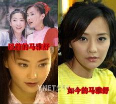 明星整容变毁容,从惊艳变毁容的惊悚历程